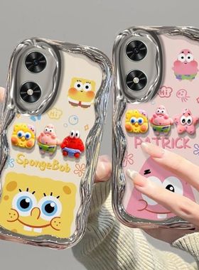 适用华为荣耀畅玩50手机壳电镀jdy-anoo软硅胶honor荣誉畅玩50plus保护套5g全包边防摔clk一an00卡通pius女款