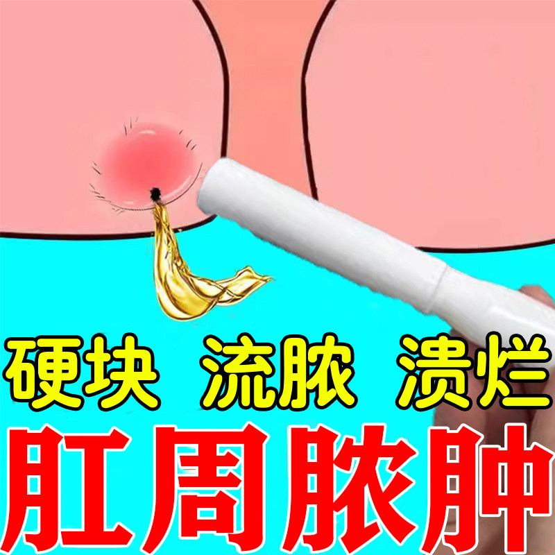 肛周脓肿愈合凝胶肛瘘拔脓封口肛周红肿疼痛肛瘘大便出血流脓硬块