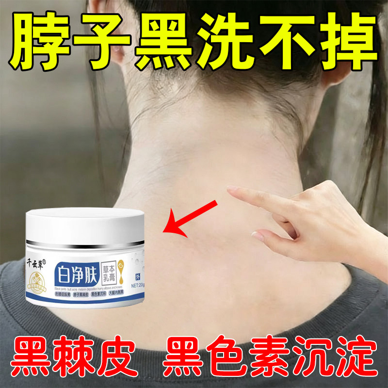 黑色素沉晒淀黑脖子洗黑不掉去黑色除素用黑皮棘大腿内侧黑脖子黑