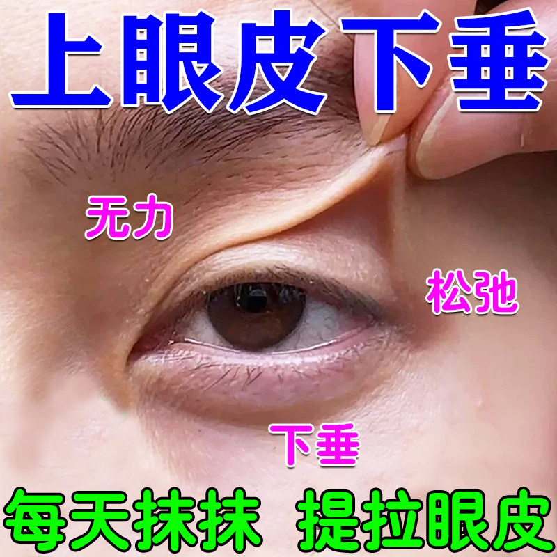 上眼皮下垂提拉眼肌无力松弛睁不开眼眼皮肿胀肿眼泡大小眼去肿
