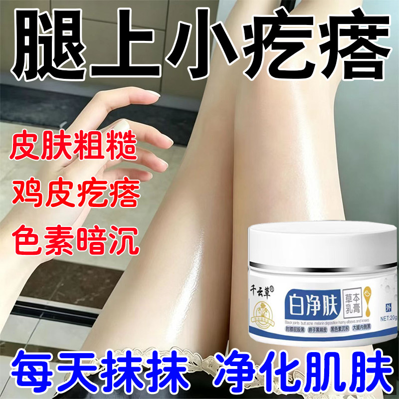 去腿部鸡疙瘩皮鱼鳞肤皮粗糙肤毛角囊质小黑点黑沉淀色素全身可用