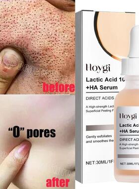 Remove Large Pores Serum Lactic Acid Facial Pore Shrinking