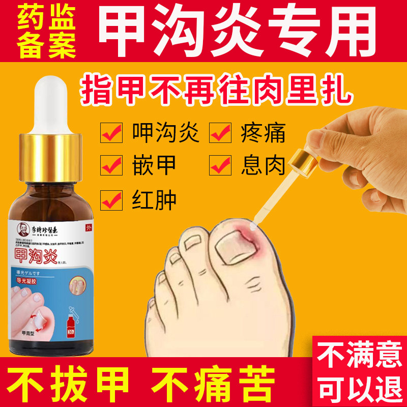 专攻甲沟炎【送修甲工具】