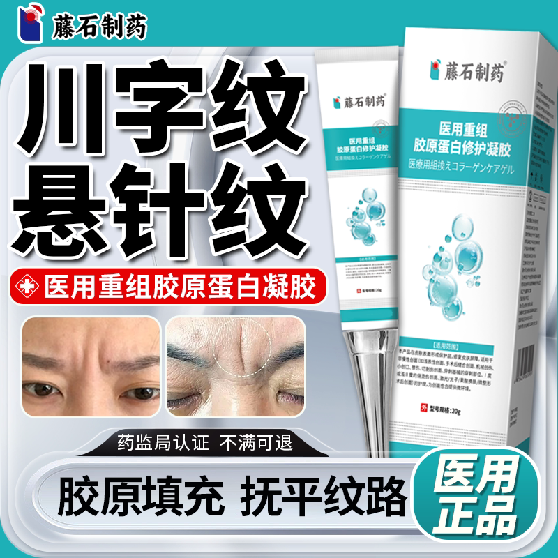 医用眉间川字纹去额头贴悬针纹除重组胶原蛋白修复凝胶官方旗舰QN