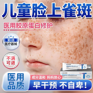 藤石制药儿童脸上雀斑脸部搭祛斑霜药膏黄褐斑晒斑淡化色斑医用QN