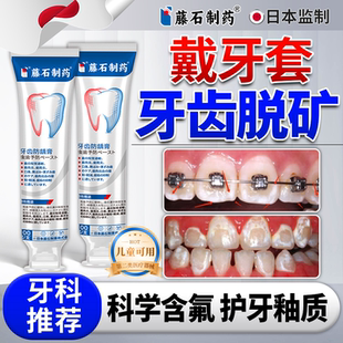 牙齿脱矿搭高含氟牙膏涂再矿化正畸防龋白斑钙化牙釉质修复儿童QN