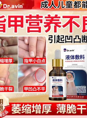 儿童甲营养不良甲床萎缩指甲凹凸不平竖纹开裂搭生长液灰指甲QN