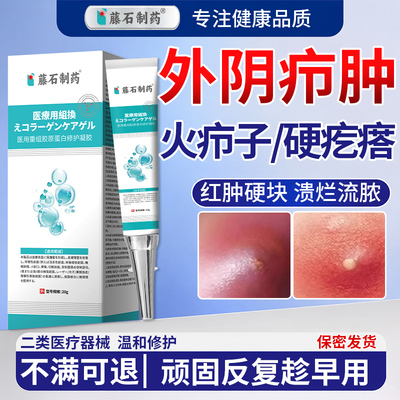 火疖子拔毒拔脓膏脓包硬块外阴疖肿私处火疖子屁股上长痘敷料贴ZJ