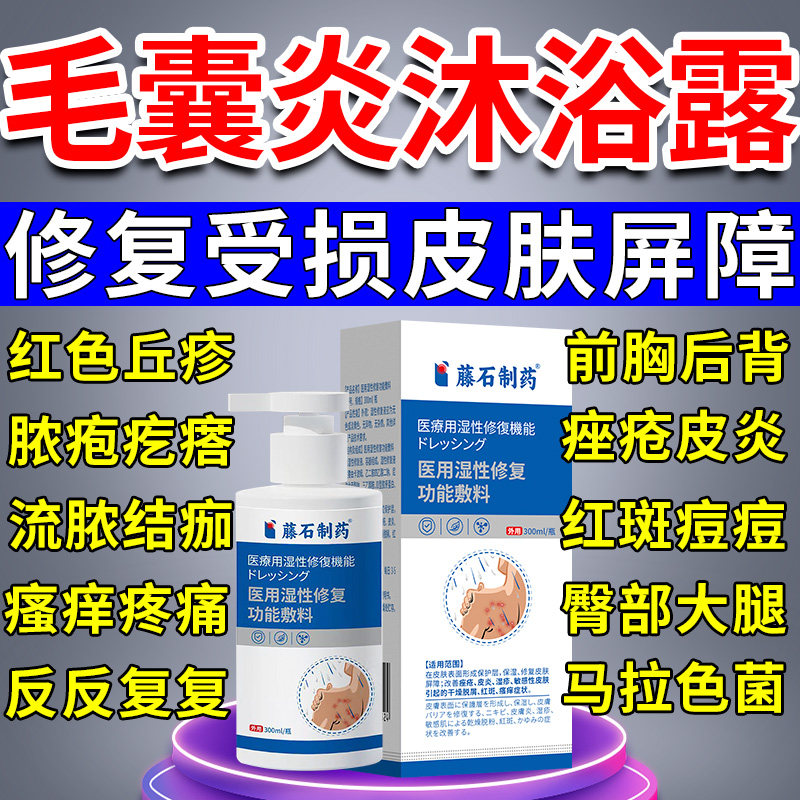 后背长痘痘毛囊炎硬疙瘩真菌感染前胸后背马拉色菌沐浴露搭香皂QN