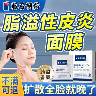 脂溢性皮炎面部面膜脸上鼻翼两侧发红起皮护肤品软膏面部修膜QN