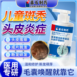 藤石制药儿童斑秃脂溢性皮炎洗发水鬼剃头遮盖生发防脱神器QN