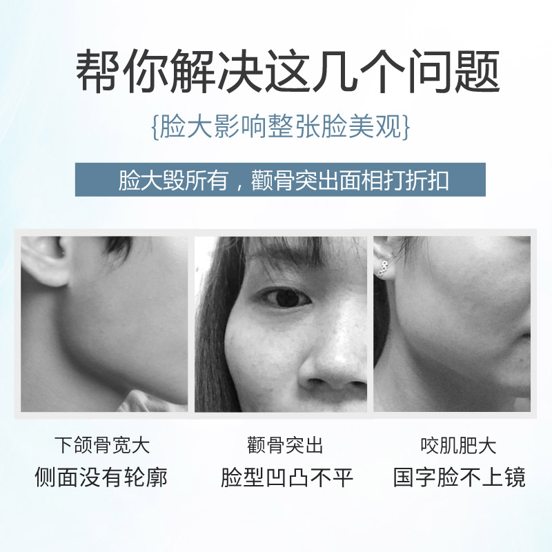 消除咬肌瘦去咬肌肥大国字脸瘦骨瘦脸神器下颌骨缩小颧骨内推矫正