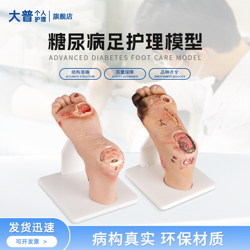 糖尿病足护理模型糖尿病人脚腿溃烂医学烂足烂脚足部病变畸形教具