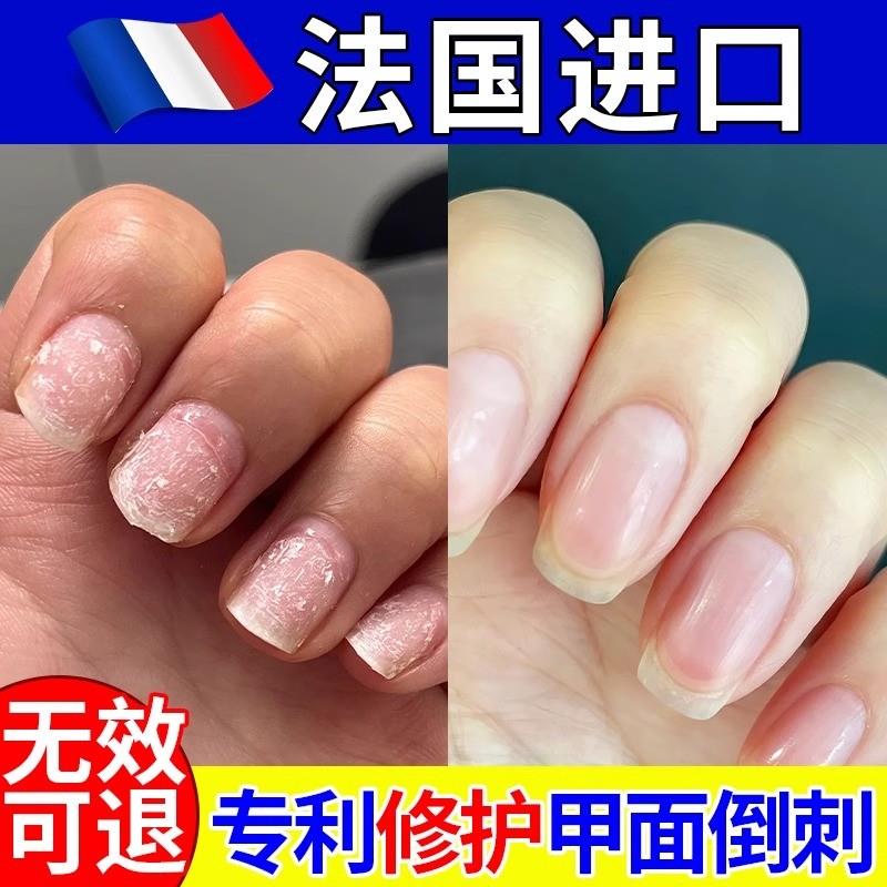 护甲油养指甲营养油增厚霜膏育甲指缘液防倒刺修复薄软开裂变硬