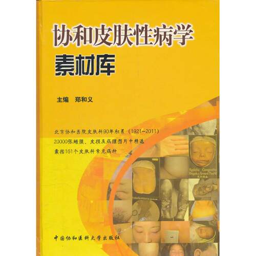 协和皮肤病学素材库郑和义 编 著作9787811365702书籍\/杂志\/报纸/医学卫生/内科学
