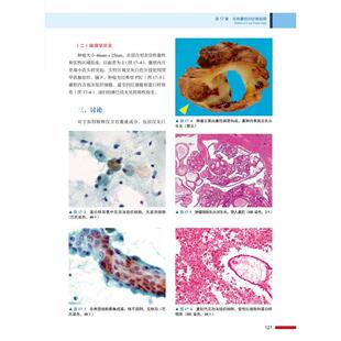 甲状腺细针穿刺细胞学 鉴别诊断与局限 原书第2版(日)肯尼奇·卡库多9787504690876书籍\/杂志\/报纸/儿童读物/童书/儿童文学