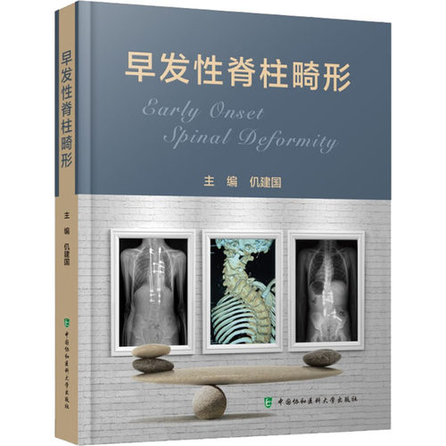 早发脊柱畸形仉建国9787567919587书籍\/杂志\/报纸/医学卫生/临床医学