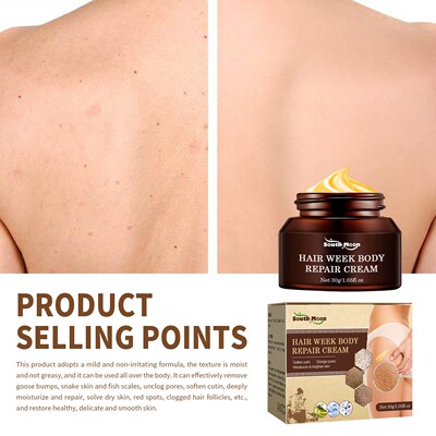 Body Cream Chicken Skin Removal Treatment Keratosis Pilaris