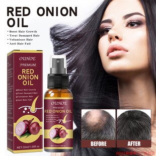 Hair Grouth Fast Onion Black Seed Essential Oils Oil Spray f