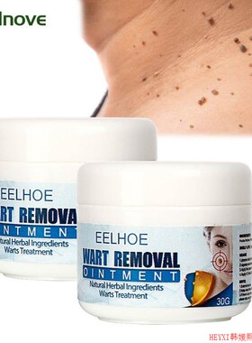 30g Skin Tag Remover Cream Warts Mole Remove Ointment Antiba