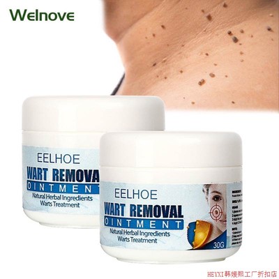 30g Skin Tag Remover Cream Warts Mole Remove Ointment Antiba