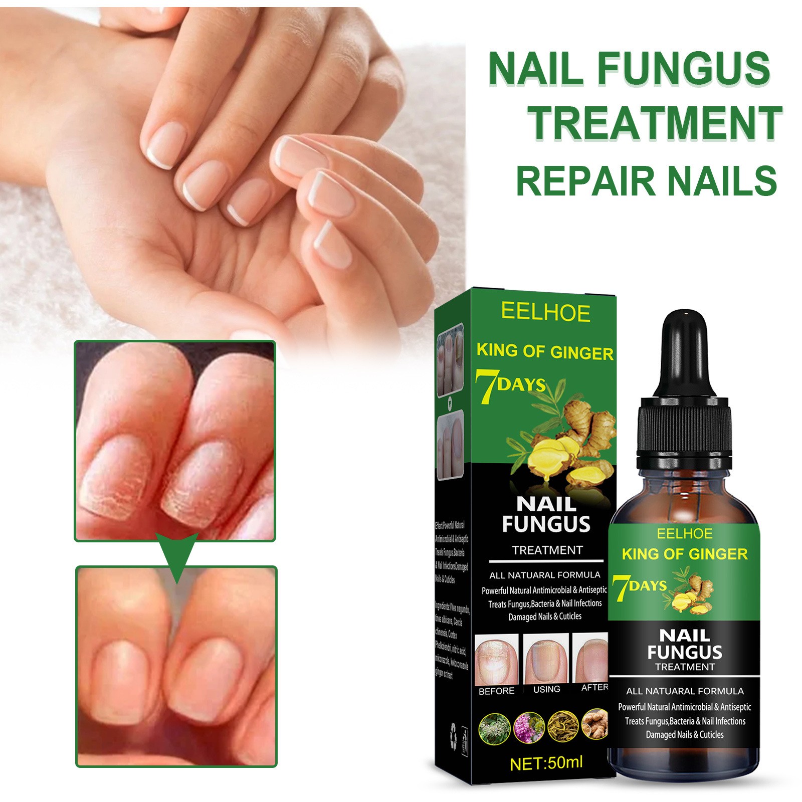 Nail Fungus Treatment Essence Serum Care Hand and Foot Care