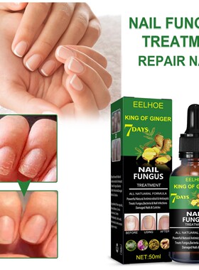 Nail Fungus Treatment Essence Serum Care Hand and Foot Care