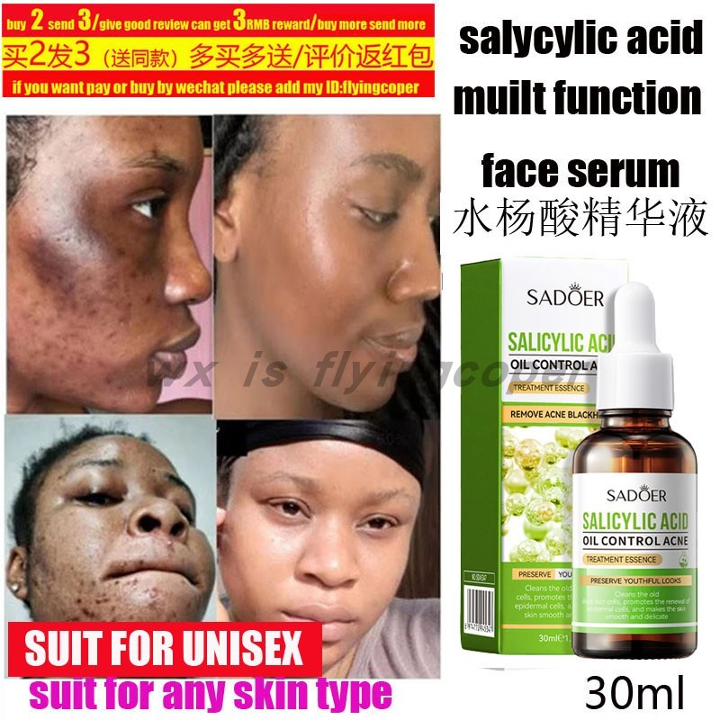 Salicylic Acid Shampoo Anti-dandruff itch Fluffy水杨酸洗发水