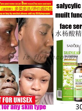 Salicylic Acid Shampoo Anti-dandruff itch Fluffy水杨酸洗发水