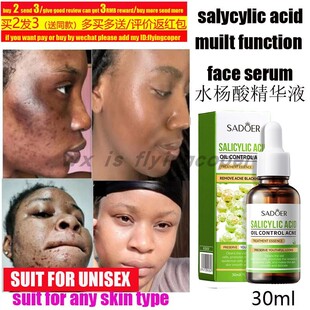 Salicylic Acid Shampoo Anti-dandruff itch Fluffy水杨酸洗发水