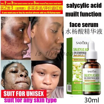 Salicylic Acid Shampoo Anti-dandruff itch Fluffy水杨酸洗发水