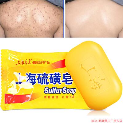 85g Shanghai Sulfur Soap Oil-Control Acne 身体磨砂膏soap