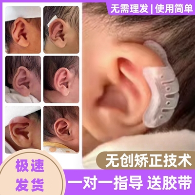 耳廓矫正器耳朵固定贴婴儿招风耳纠正贴医用硅胶胶带新生儿童宝宝