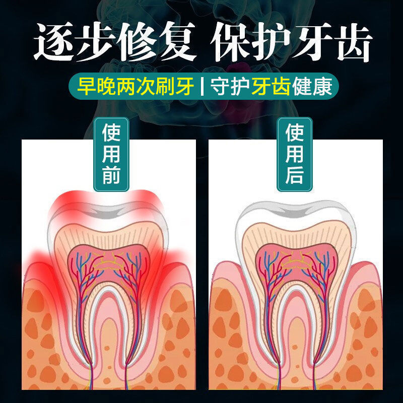 99%治好牙松】牙齿洁离剂牙齿松动固齿牙膏修复牙萎缩专用牙膏LM