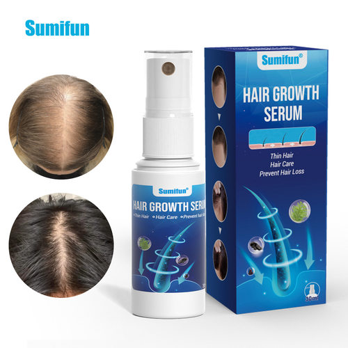 Sumifunantihairlosscondit