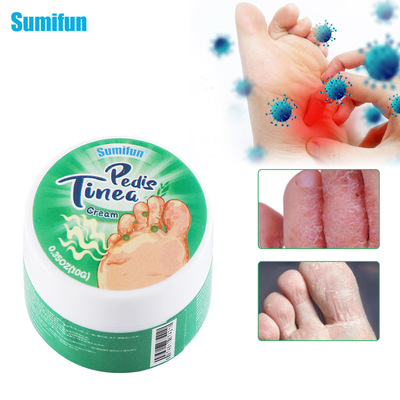 Sumifontemuathlete'sfoot