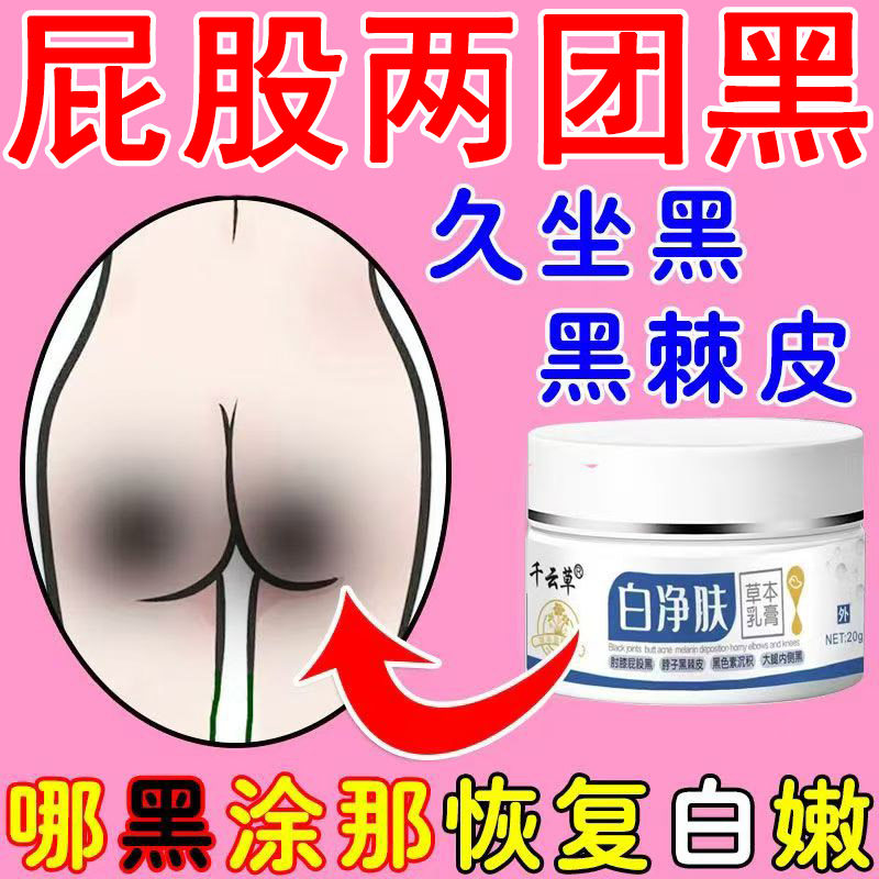 屁股去黑痘印坐印膏淡化黑色素沉淀去除部腋窝胳膊肘黑臀部发黑膏