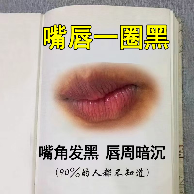 唇周一圈黑嘴巴起皮干裂泡上疹火滋润修复唇乳愈膏宁20g/盒涂抹膏