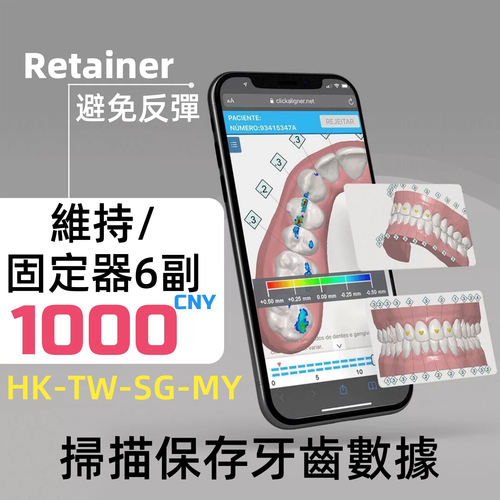 固定器維持器牙齒定做隱形透明矯正神器保持牙套盒Retainer clear
