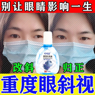 斜视矫正训练器聚散球纠正儿童成人内外弱视斗鸡眼三棱眼镜眼药水