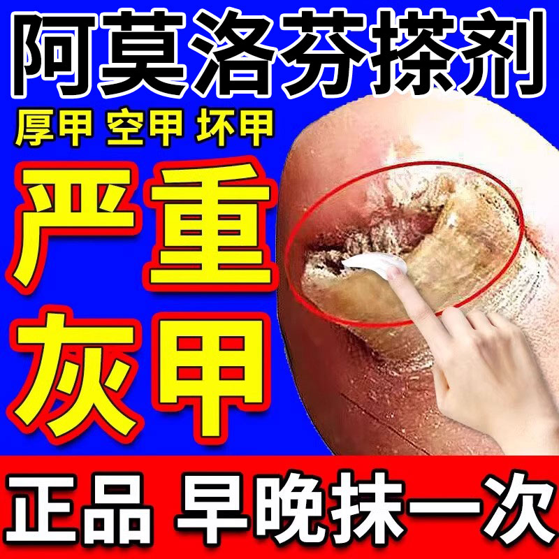 香港大药房盐阿莫搽剂灰指甲亮酸洛芬净罗甲乳膏官方正品旗舰店