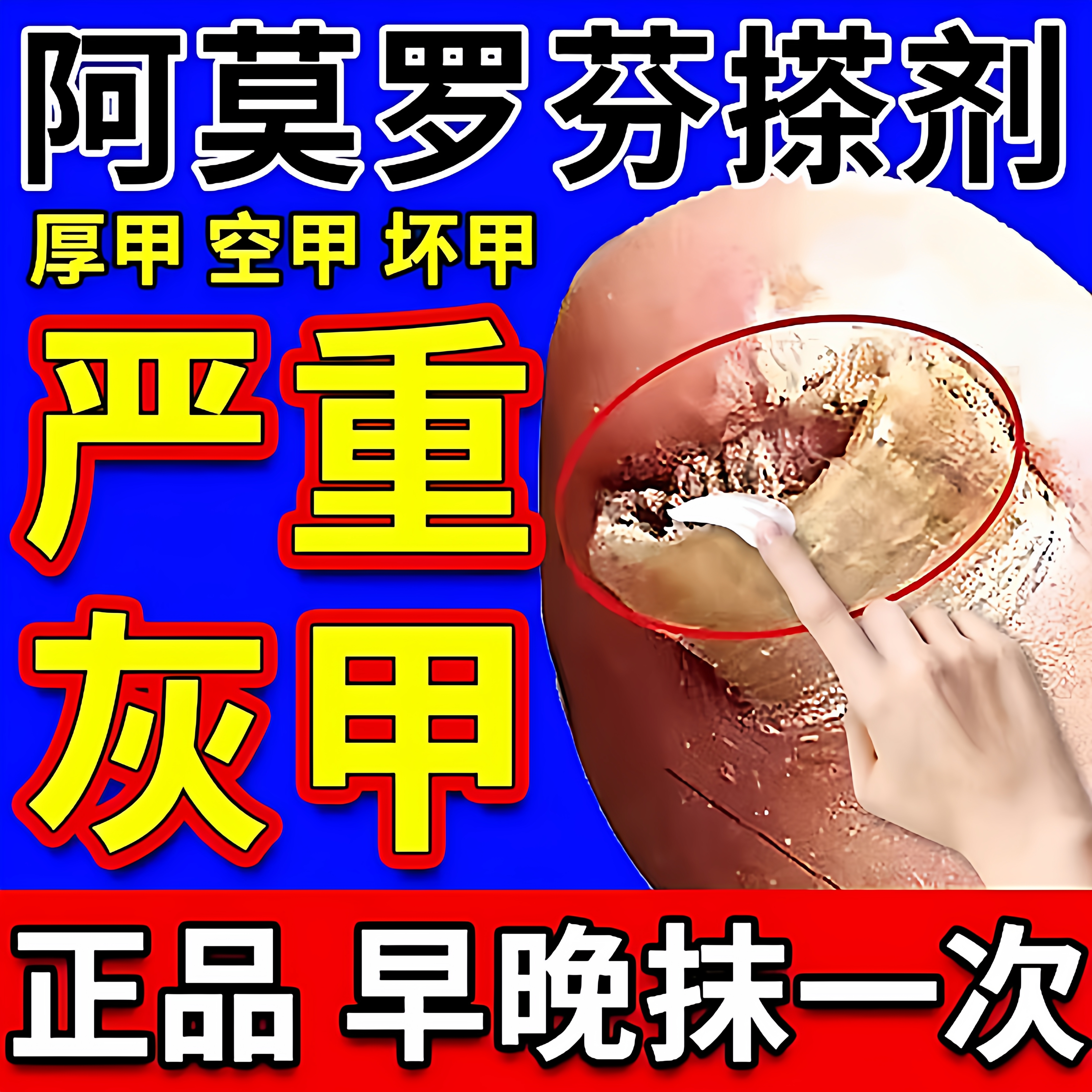 香港大药房官方正品盐酸阿莫洛芬罗芬搽剂灰指甲净亮甲乳膏旗舰店
