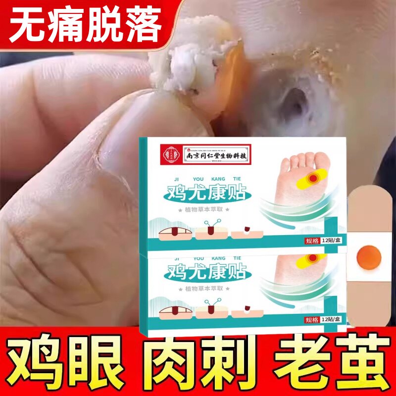 专治去鸡眼贴鳮眼膏去除跖疣祛疣膏根药水刺猴外用医用级旗舰店