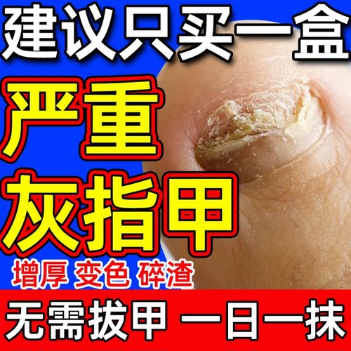 香港大药房灰指甲抑菌液脱甲膏真菌感染增厚脱落易碎脚趾空甲沟炎
