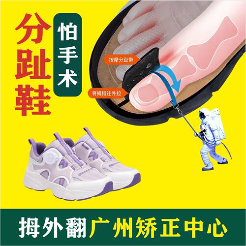拇外翻分趾鞋免手术矫正