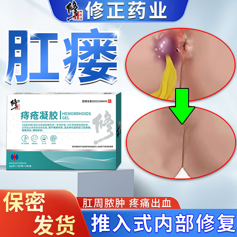 肛瘘封口膏药克星专用内口拔脓膏神器肛周脓肿硬块消炎伤口愈合