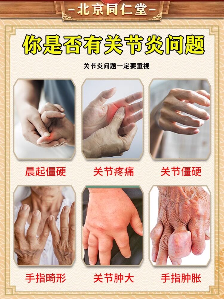 手指骨关节炎专用膏药贴变形肿大手疼痛粗大类风湿键销炎热敷神器