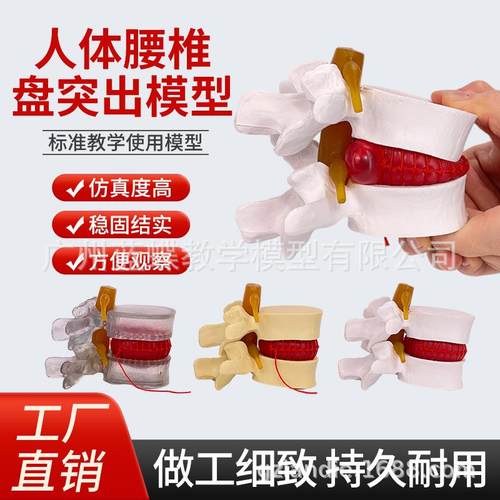 腰椎放大腰椎间盘受压演示模型人体脊柱脊椎骨病理演示关节医学用