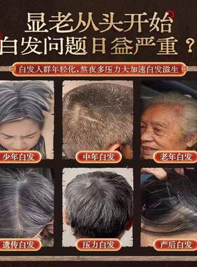 按摩梳非遗传手HWZ工何首乌乌承发滋养发发部合香梳经络梳舒缓压