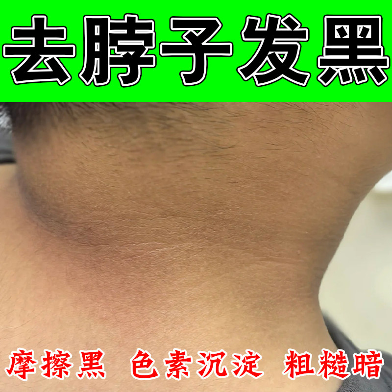脖子黑色素洗不干净后颈部腋下脖子沉淀黑棘皮暗沉粗糙皮肤按摩膏